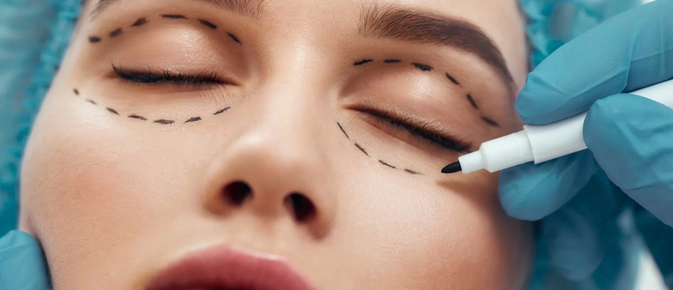 İzmir Göz Kapağı Estetiği