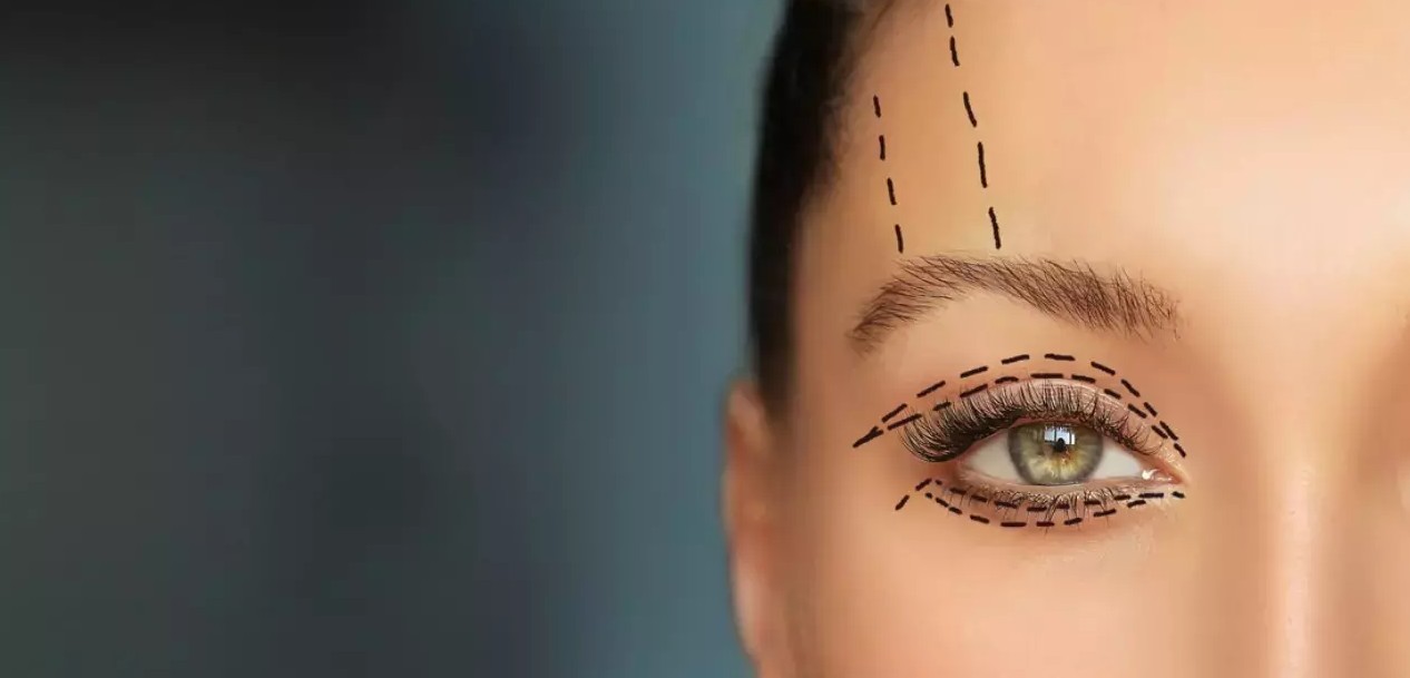 İzmir Göz Kapağı Estetiği