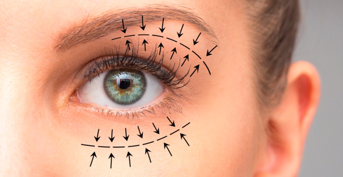 İzmir Göz Kapağı Estetiği