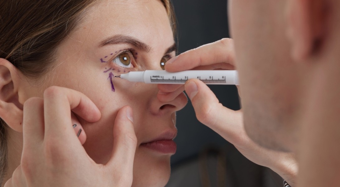 İzmir Göz Kapağı Estetiği