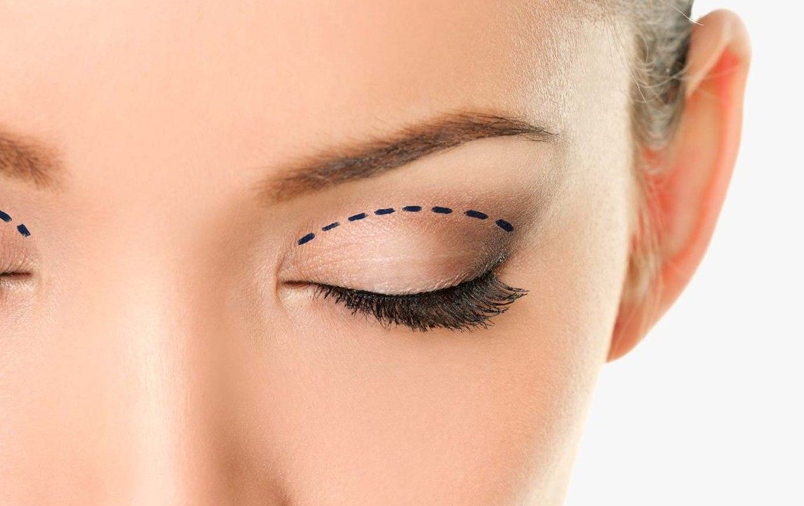 İzmir Göz Kapağı Estetiği